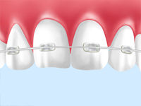 矯正歯科
